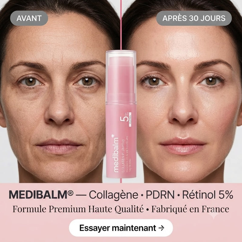 Résultats Ressentis