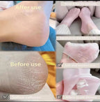 SoftStep — Chaussettes Hydratantes Silicone Soin Pieds